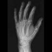 Hand X-ray
