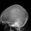 Skull X-ray